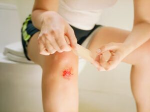 Lee más sobre el artículo Científicos crean vendas hechas con hongos vivos que podrían regenerar la piel humana